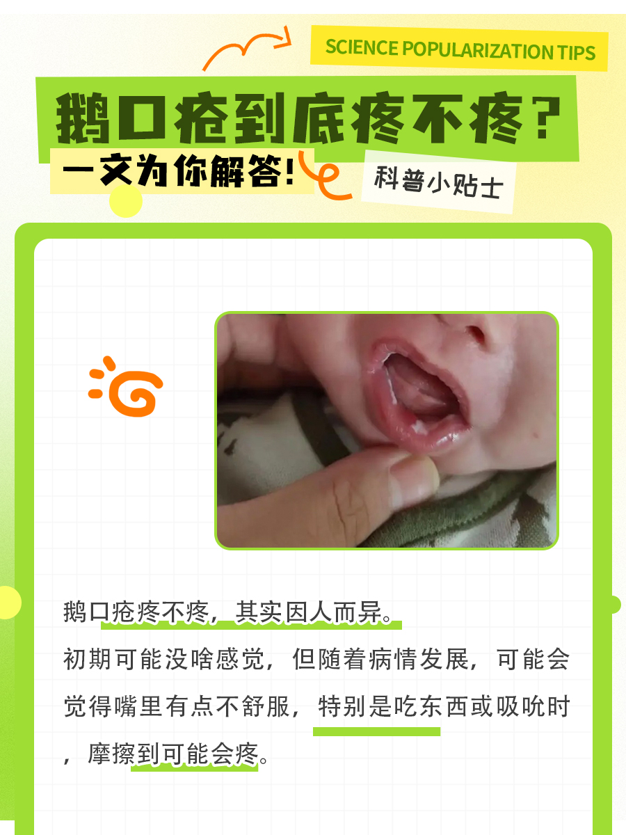 鹅口疮到底疼不疼？一文为你解答！