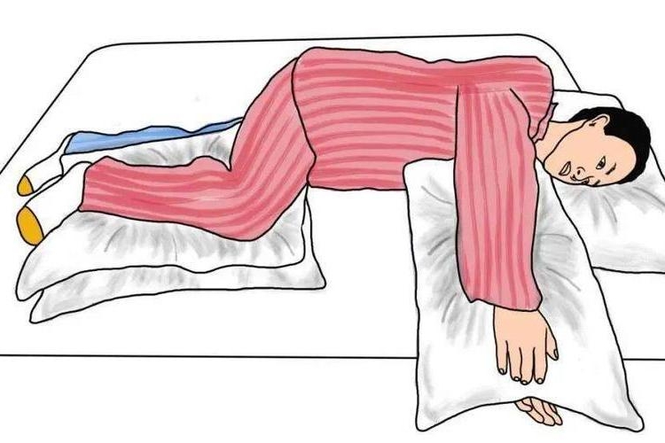 偏瘫患者健侧卧位图 偏瘫患者健侧卧位图