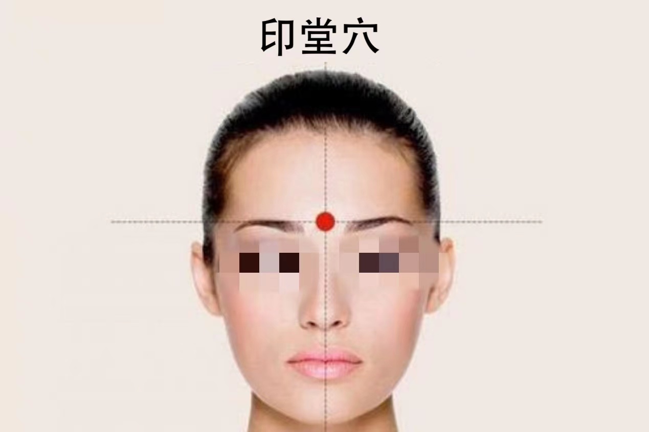 印堂穴图