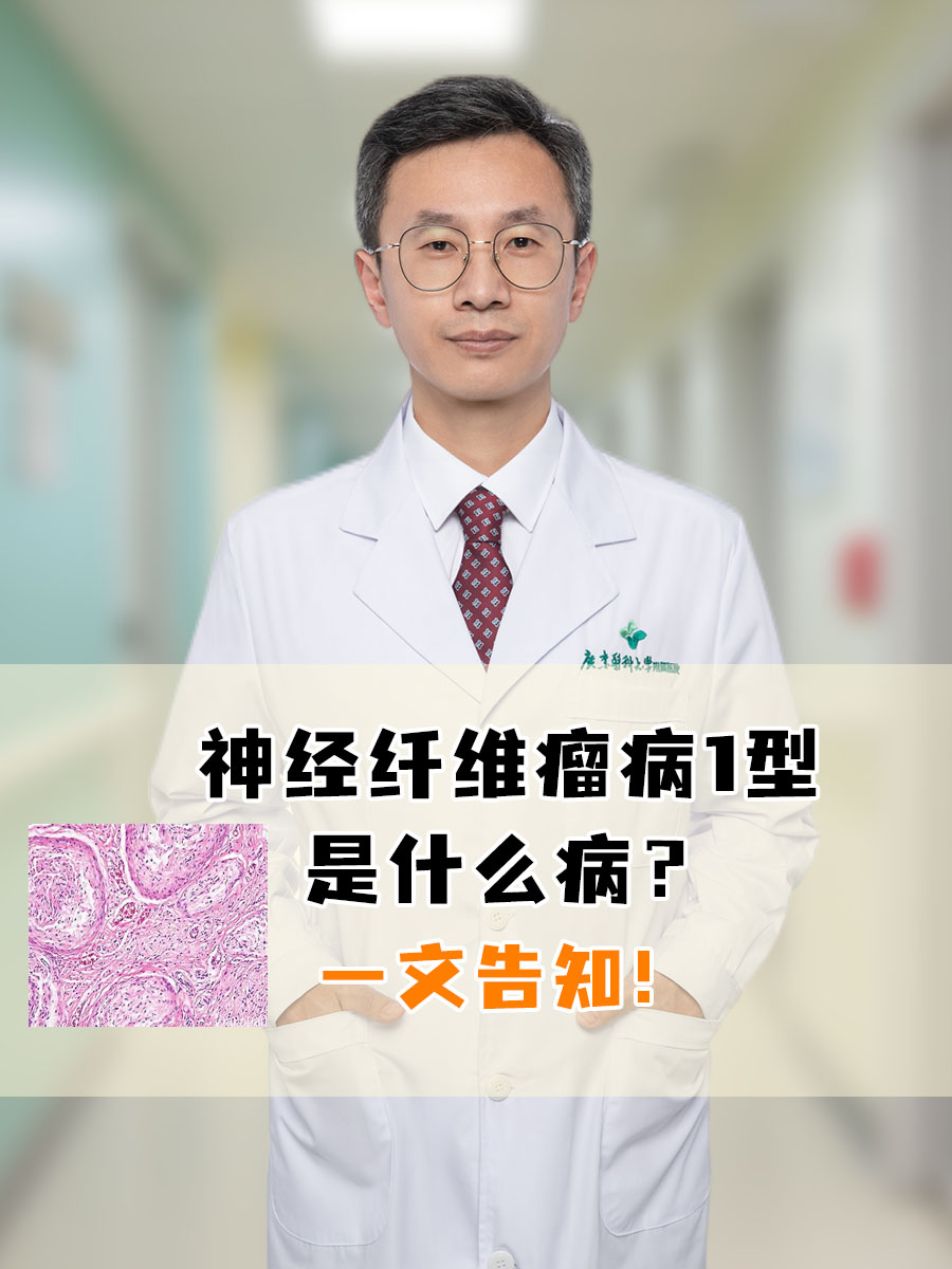 神经纤维瘤病1型是什么病？一文告知！