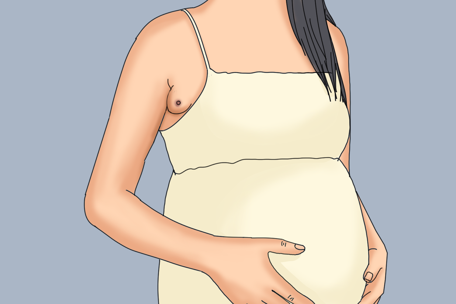 孕期副乳长乳头图