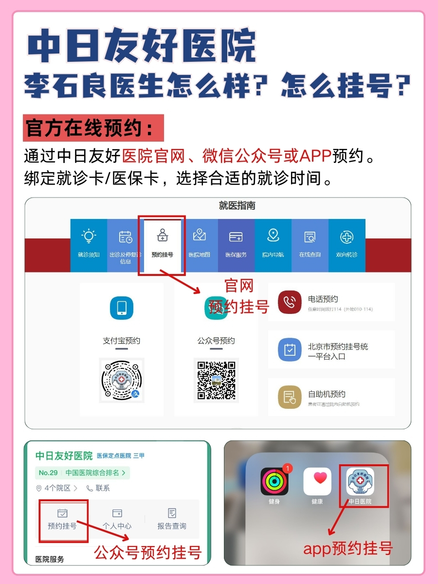 中日友好医院李石良医生怎么样？怎么挂号？