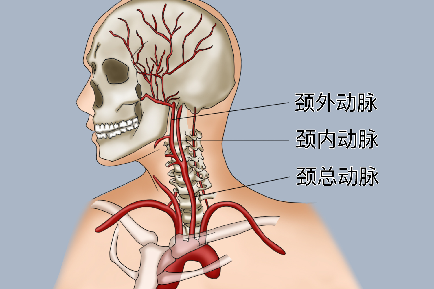 颈总动脉及颈内、外动脉图