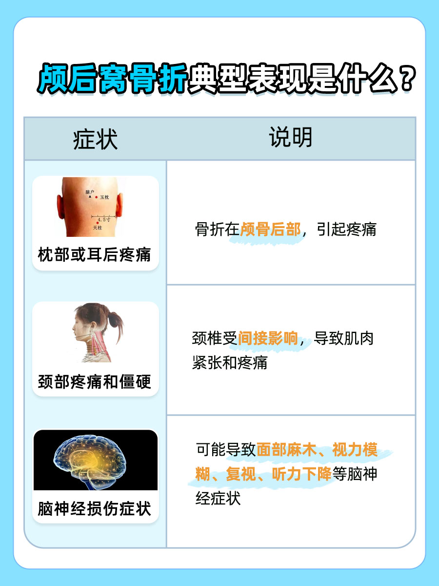 颅底骨折:识别颅后窝骨折的典型症状