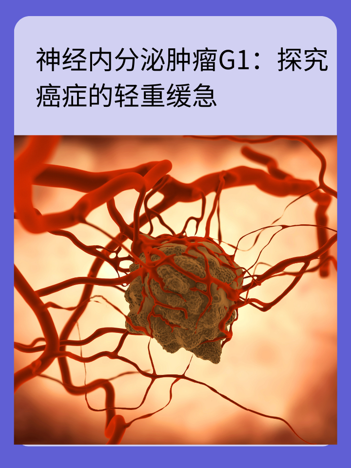 神经内分泌肿瘤G1：探究癌症的轻重缓急