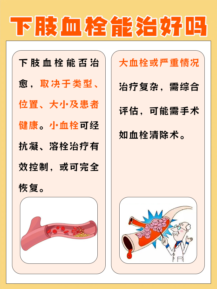 探索下肢血栓能不能治好