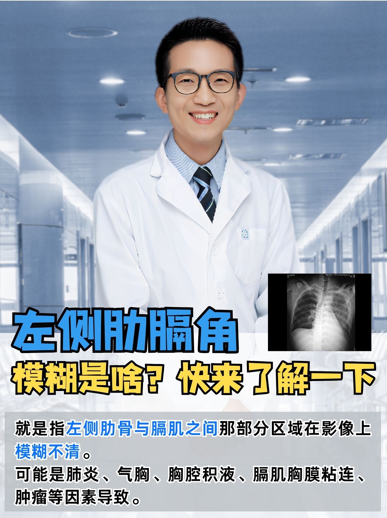 左侧肋膈角模糊是啥？快来了解一下