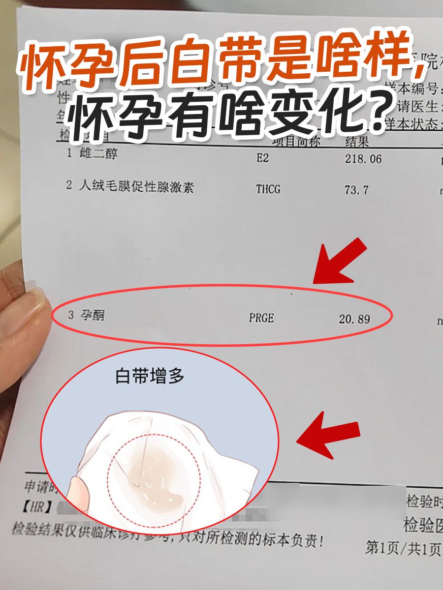 怀孕后白带是啥样，怀孕有什么变化？