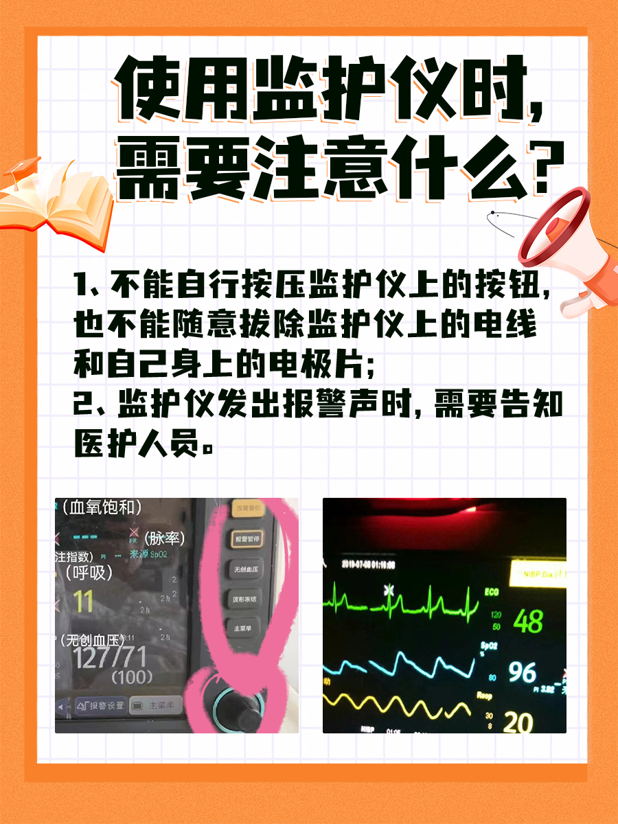 监护仪上的PLETH，你知道是什么吗？