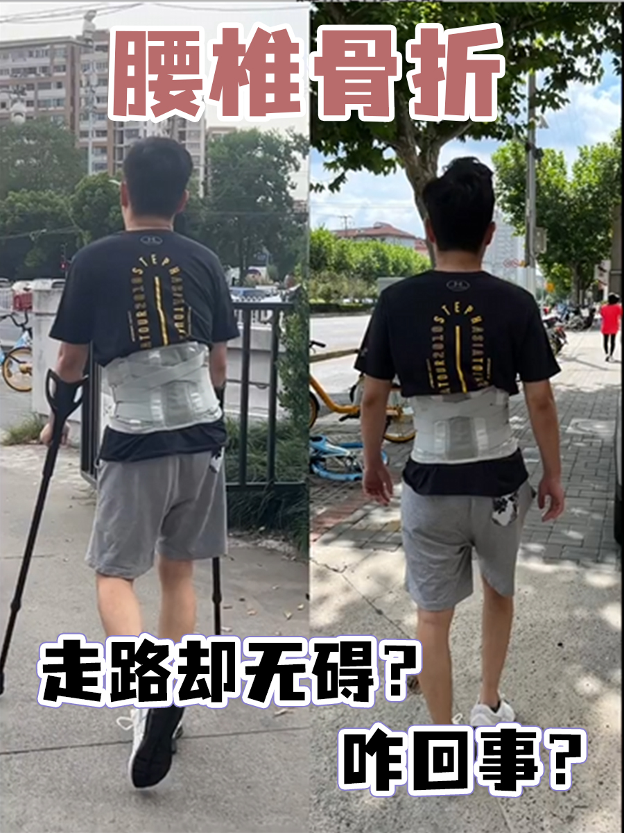 腰椎骨折,走路却无碍?咋回事?