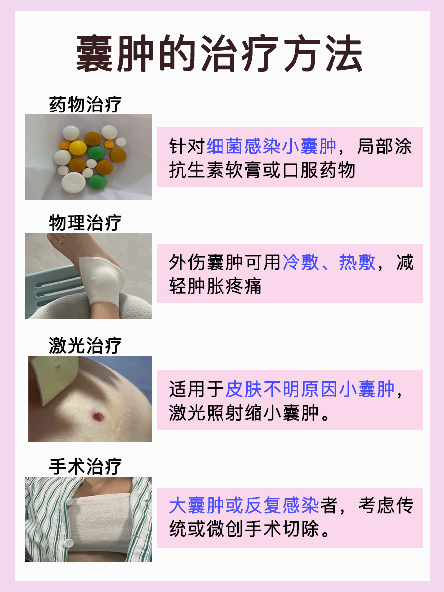 囊肿来袭!它的触感是硬邦邦还是软绵绵?