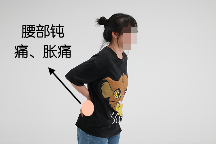 肾结石疼痛部位图