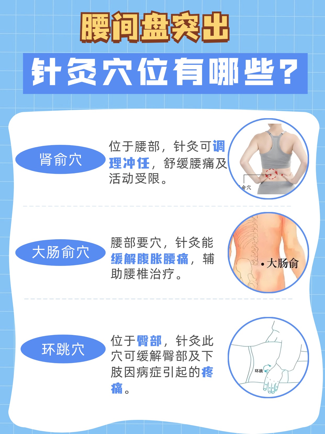 腰间盘突出针灸：这几个穴位搞定