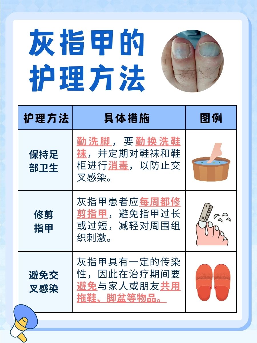 灰指甲凝胶——是否能起到治疗效果?