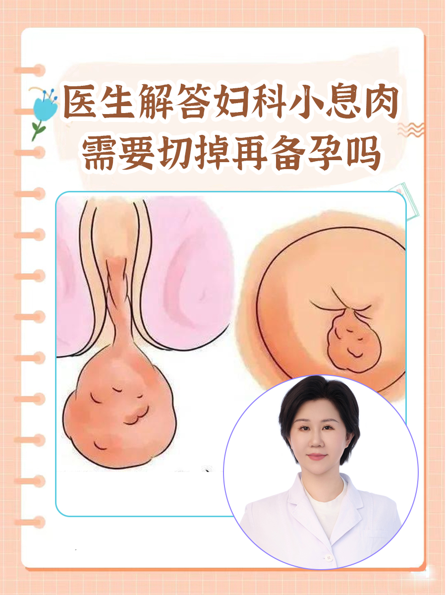 医生解答妇科小息肉需要切掉再备孕吗