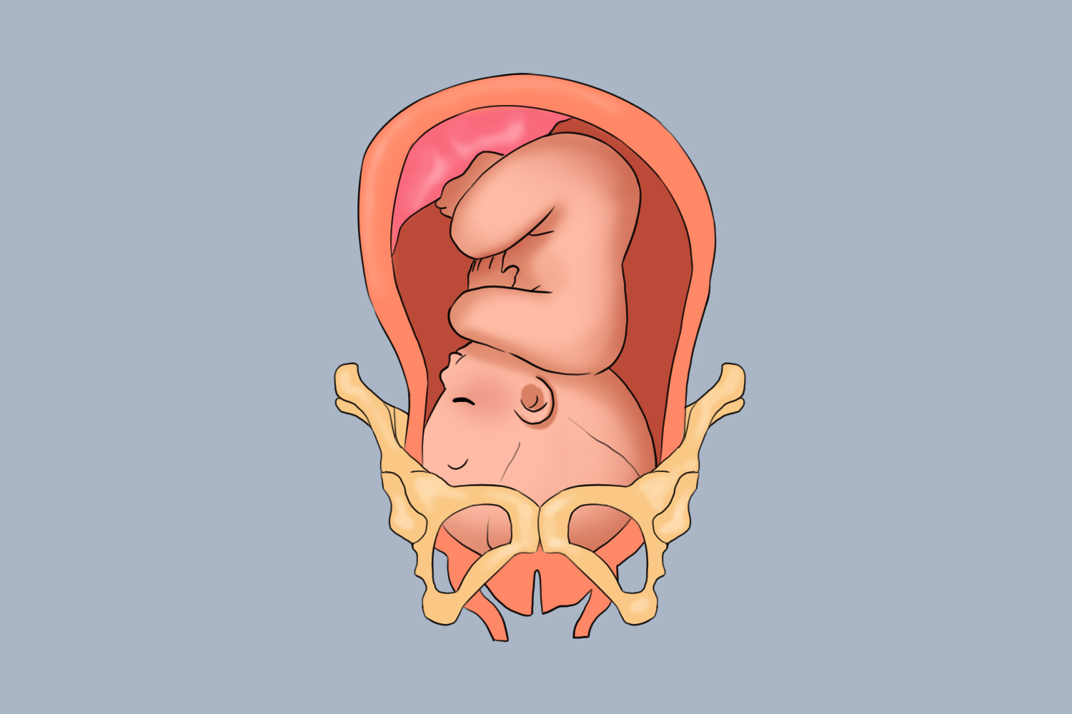 胎头位置低图 胎头位置低图