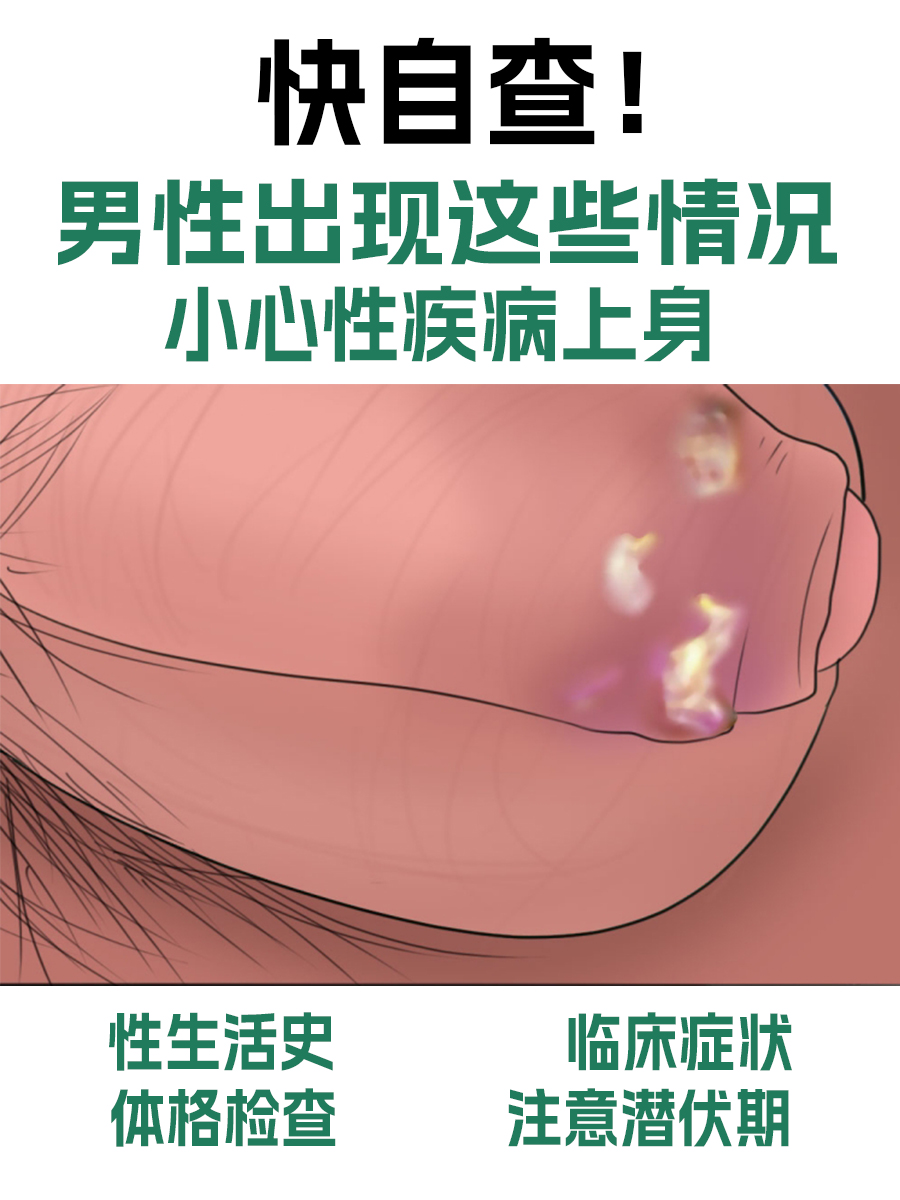 快自查！男性出现这些情况，小心性疾病上身