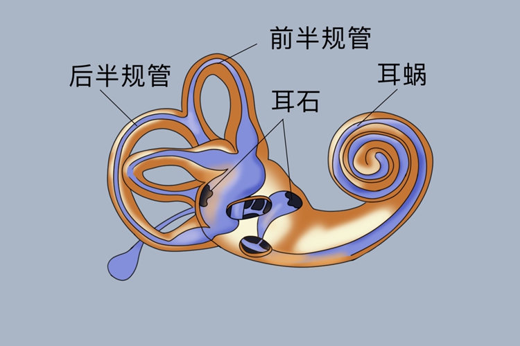 耳石在头部位置图