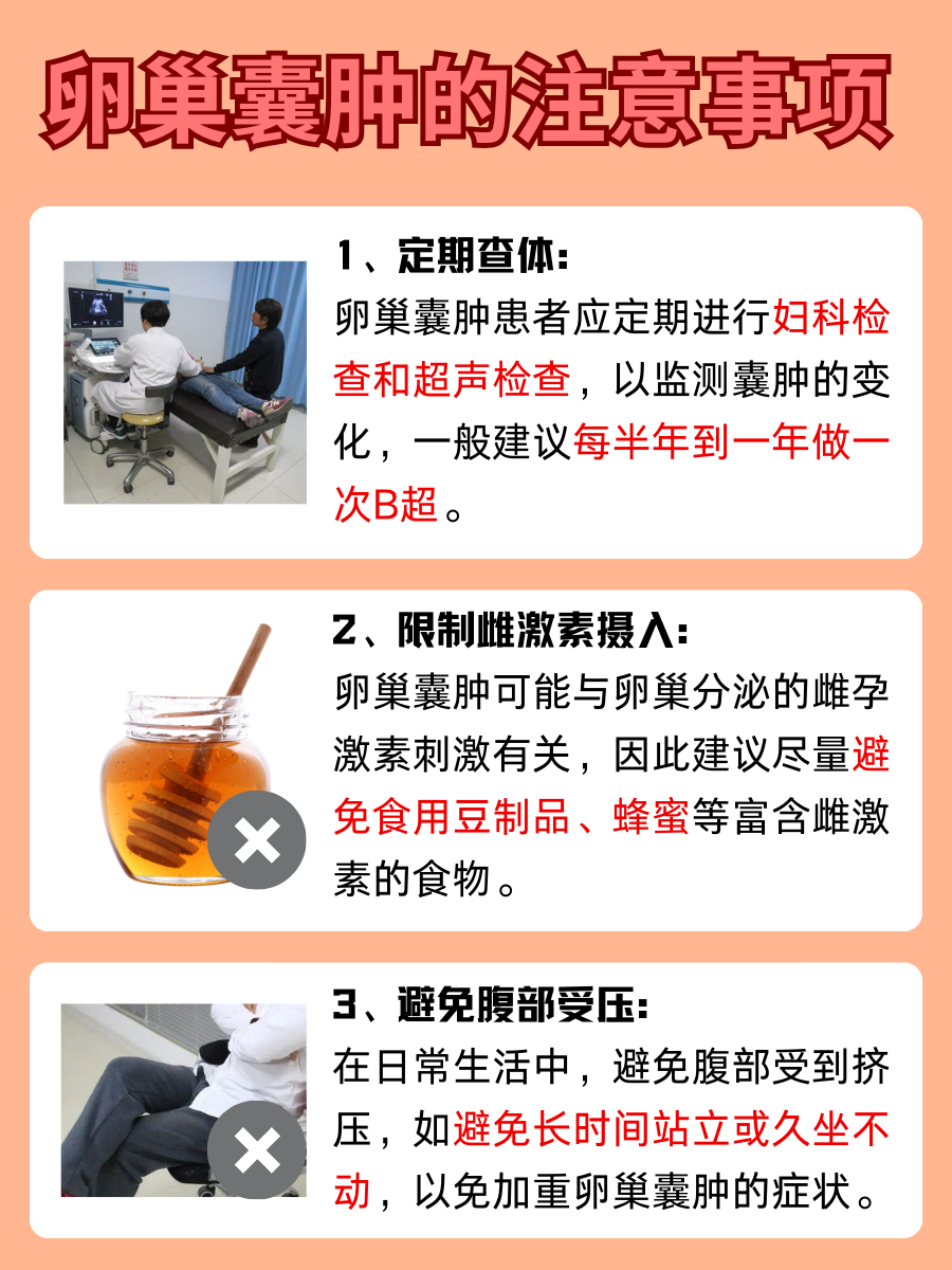 卵巢囊肿的“信号”：这些症状别忽视