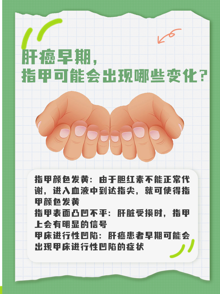 指甲出现这些变化,当心肝癌!