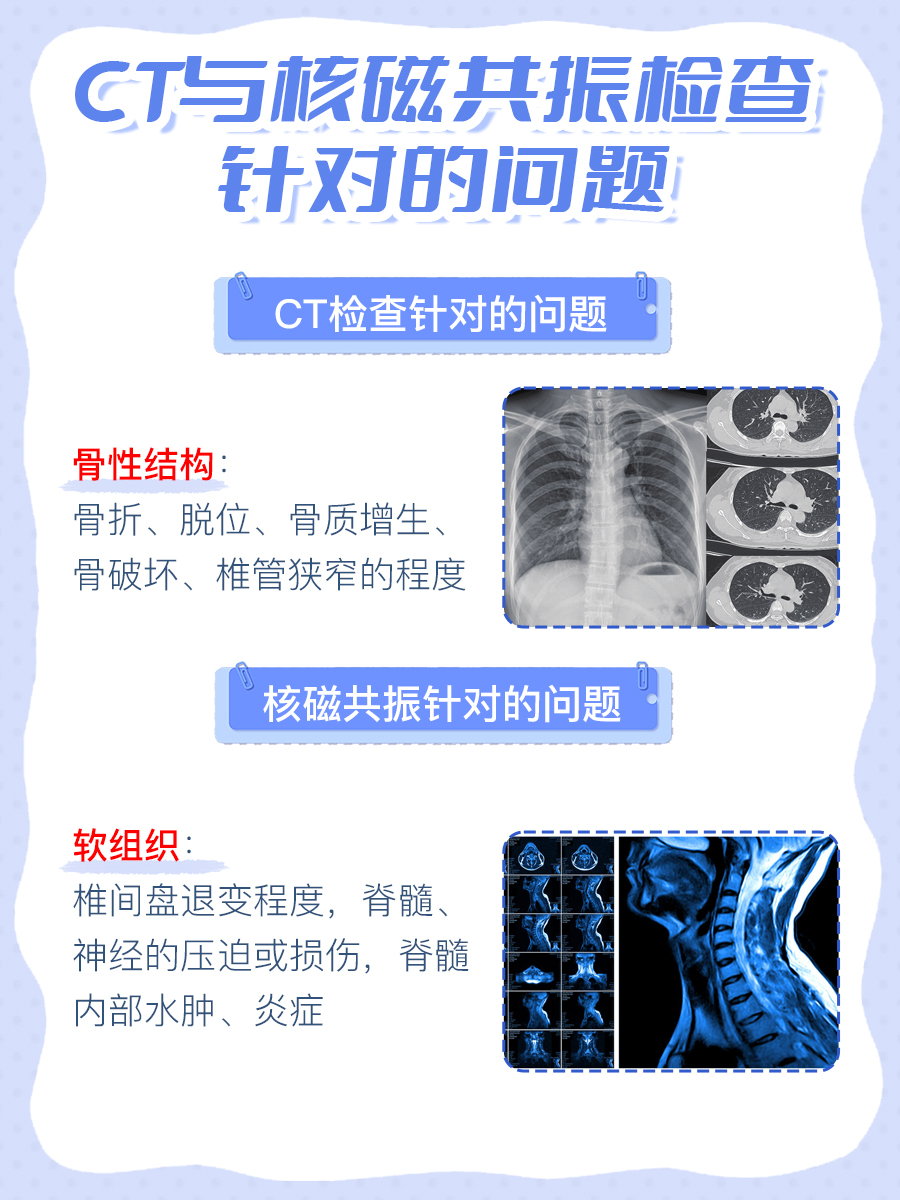 颈椎病应该做CT还是核磁共振？因情况而异