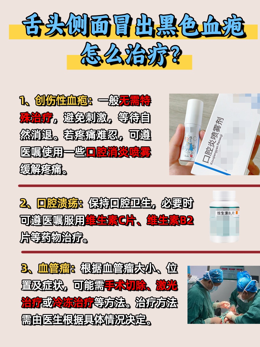 舌头侧面冒出黑色血疱是怎么回事？看完就懂了