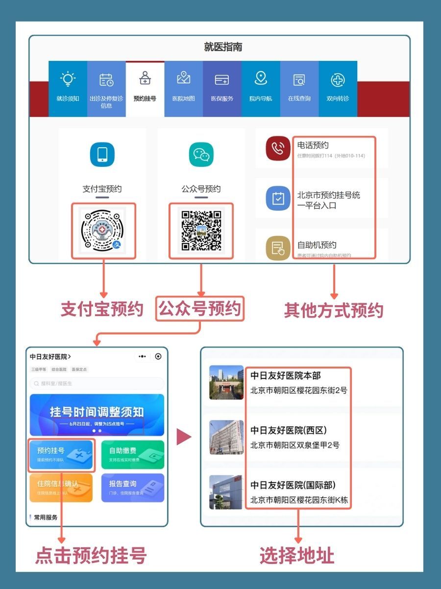 中日友好医院谭昭怎么样？怎么挂号？