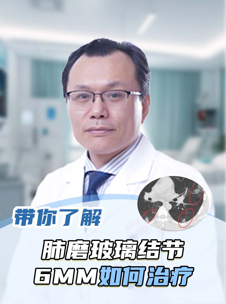 带你了解：肺磨玻璃结节6mm如何治疗