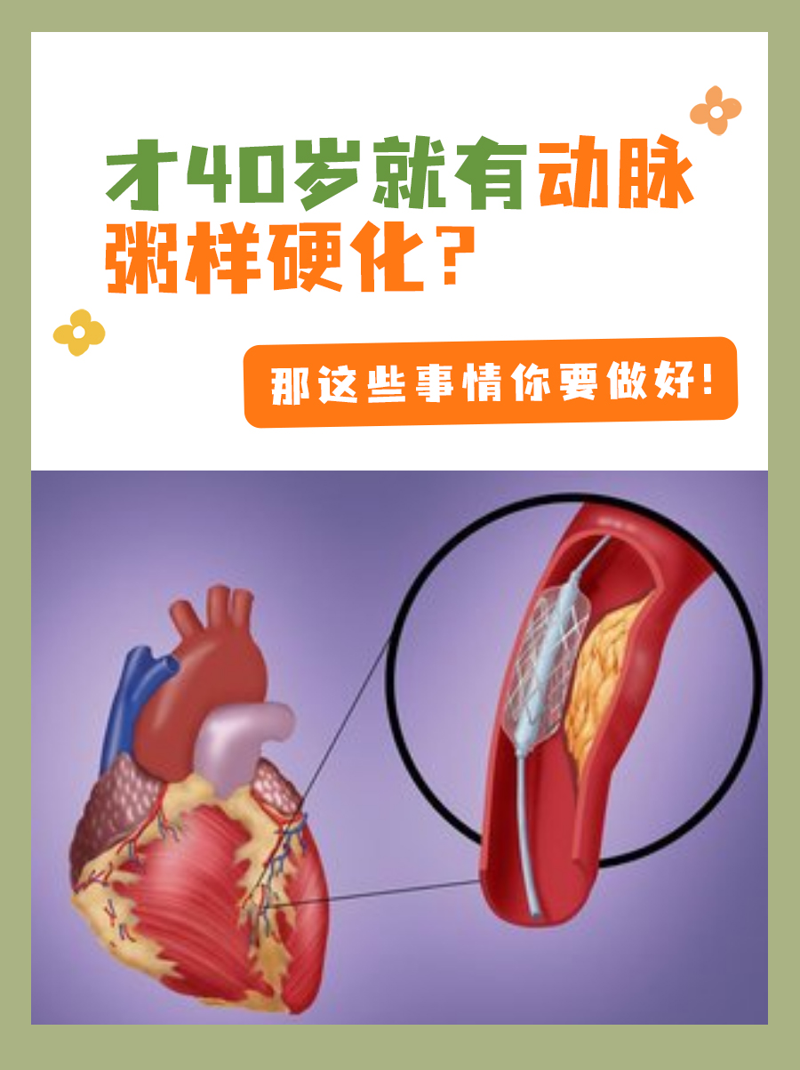 才40岁就有动脉粥样硬化?那这些事情你要做好