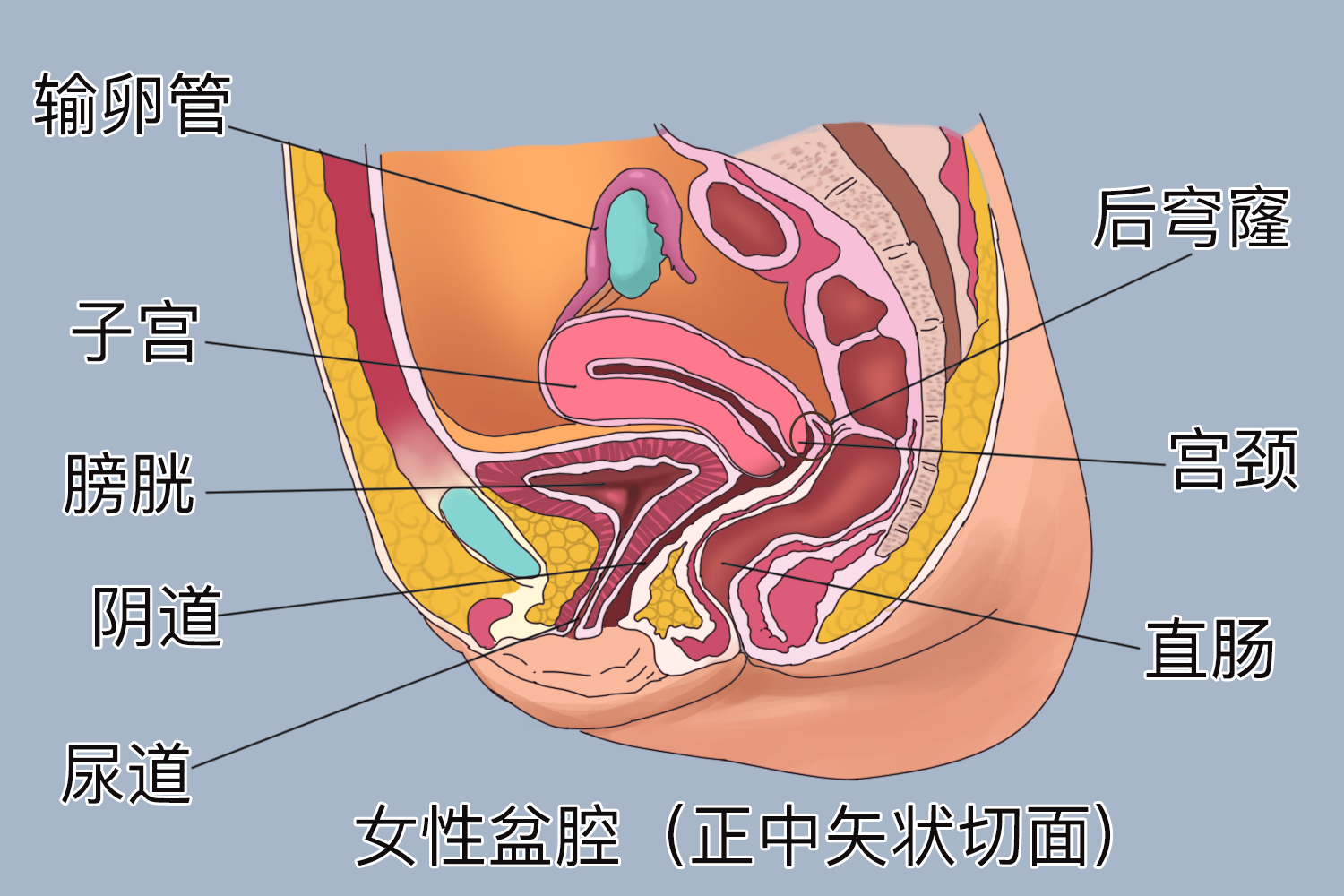 阴道后穹窿位置图