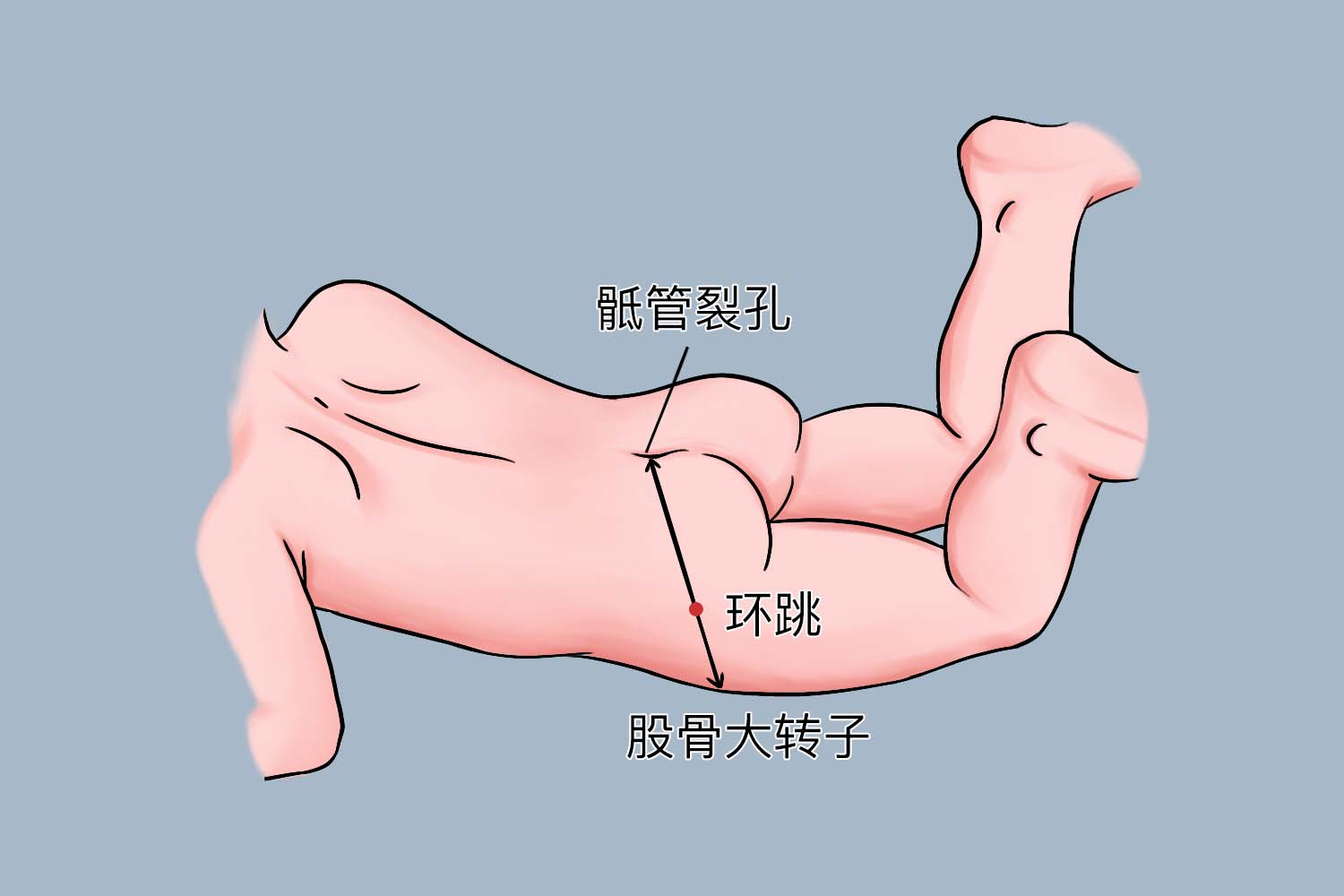 尾骨生理性凹陷图 尾骨生理性凹陷图