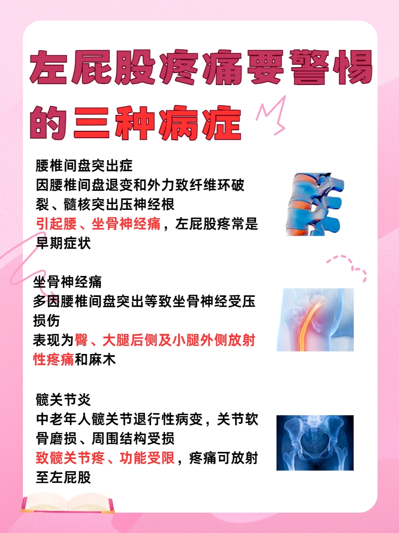 揭秘！左屁股疼痛要警惕哪三种病症？