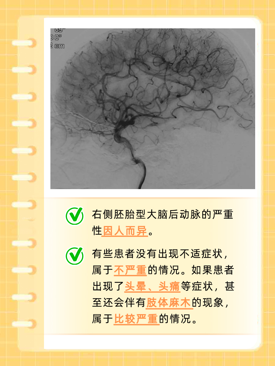 右侧胚胎型大脑后动脉严重吗？揭秘真相！