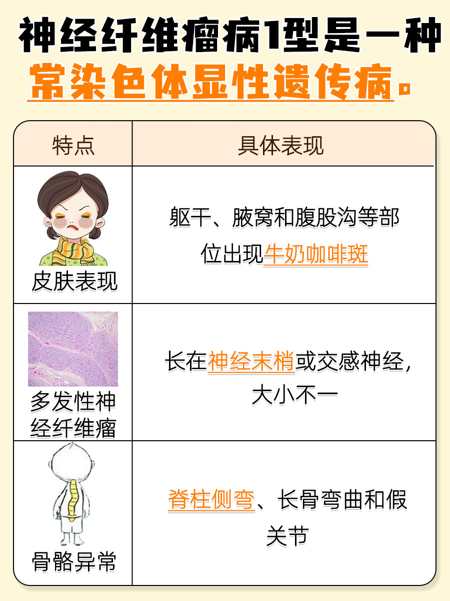 神经纤维瘤病1型是什么病？一文告知！