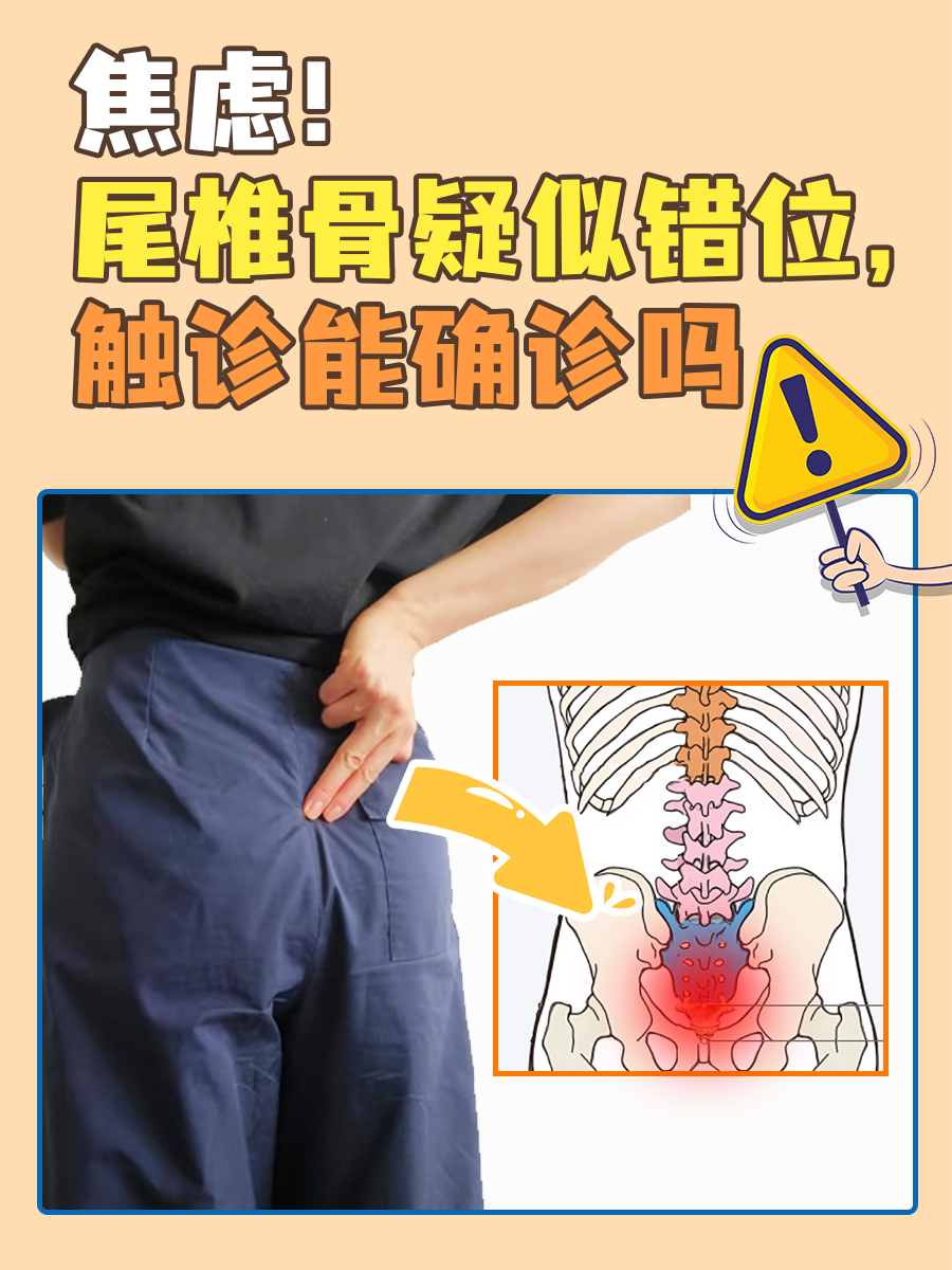 焦虑！尾椎骨疑似错位，触诊能确诊吗
