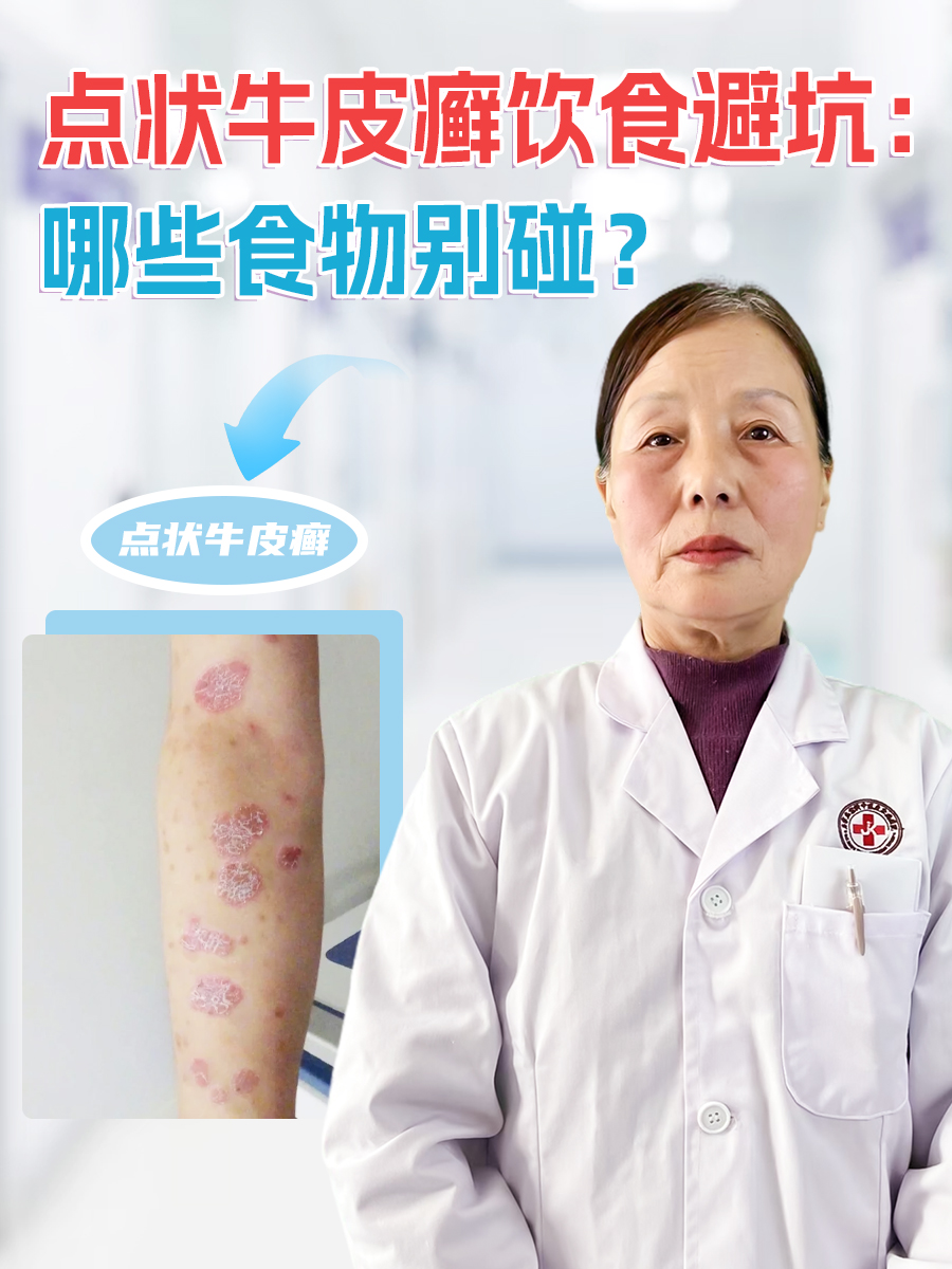 点状牛皮癣饮食避坑：哪些食物别碰？