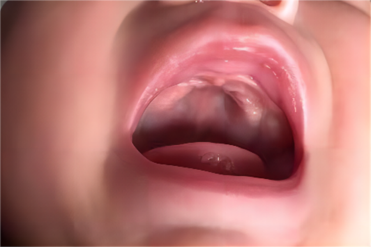 三个月宝宝正常口腔图