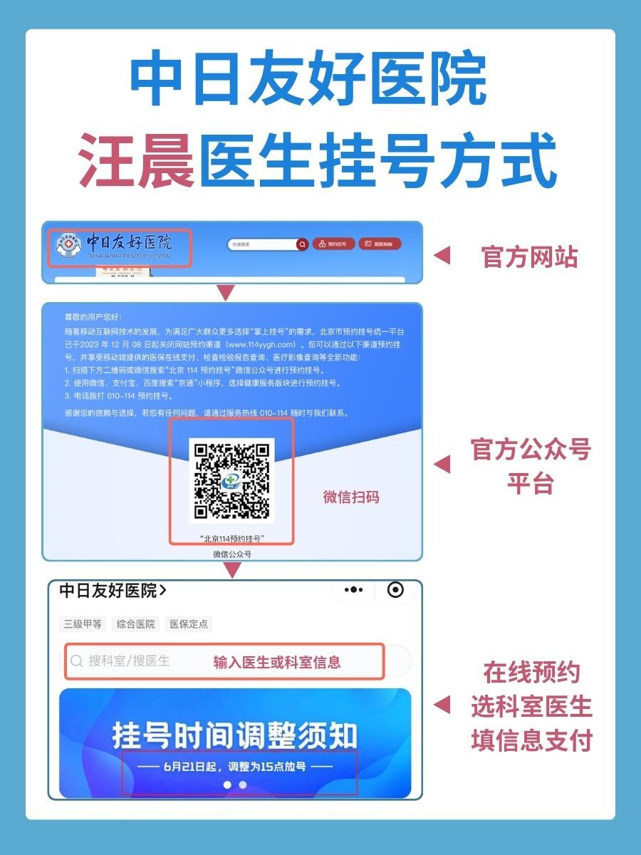 中日友好医院汪晨医生怎么样？怎么挂号？