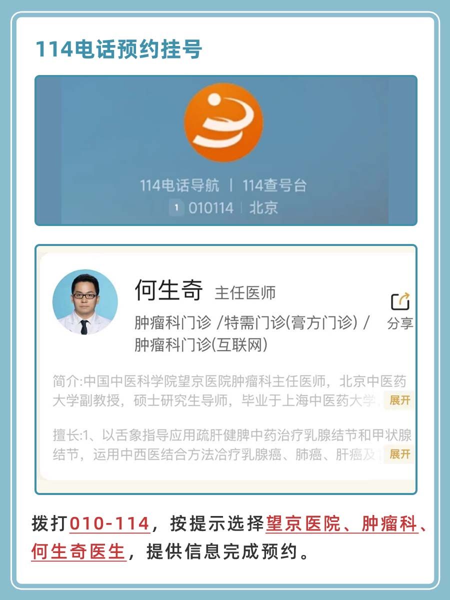 北京望京医院何生奇医生怎么样?怎么挂号?