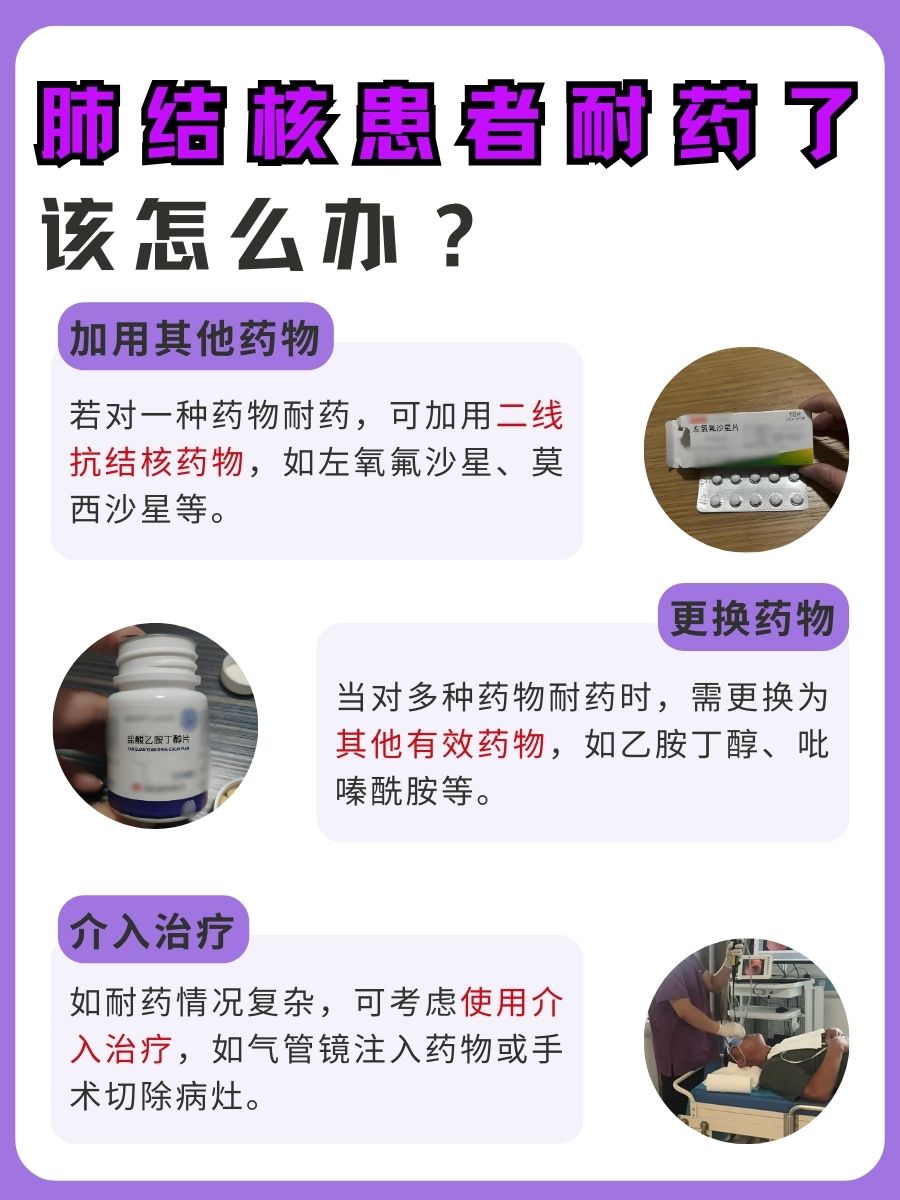 肺结核一旦耐药终身耐药吗？并不是！