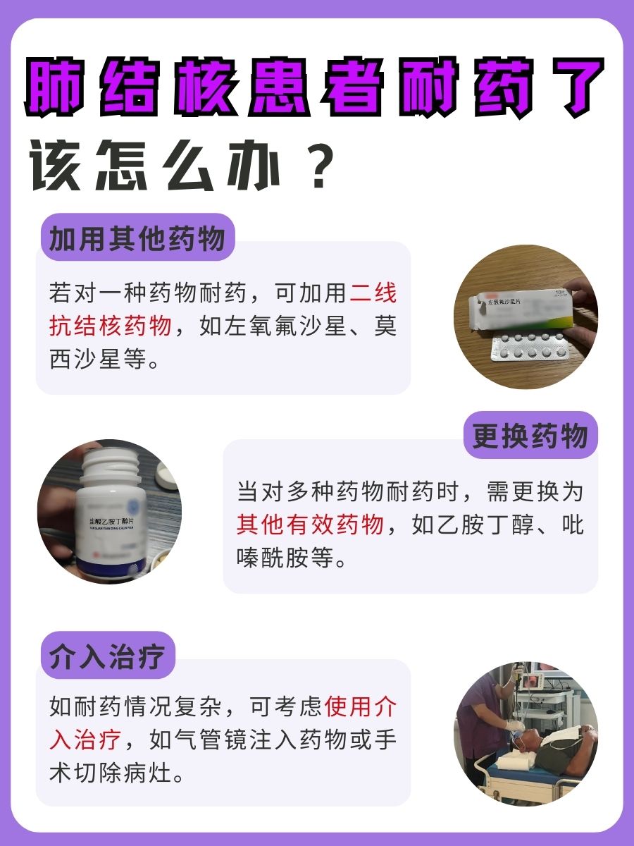 肺结核一旦耐药终身耐药吗？并不是