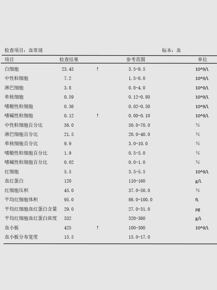 骨髓增殖性肿瘤（女子确诊慢性粒细胞白血病，常规服药恢复正常生活！）.jpg