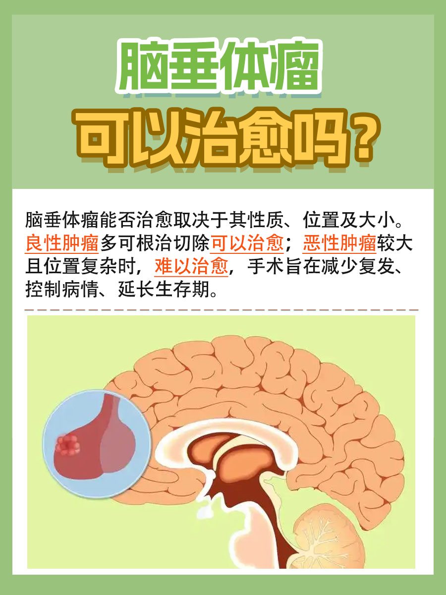 医生解答：脑垂体瘤可以治愈吗？