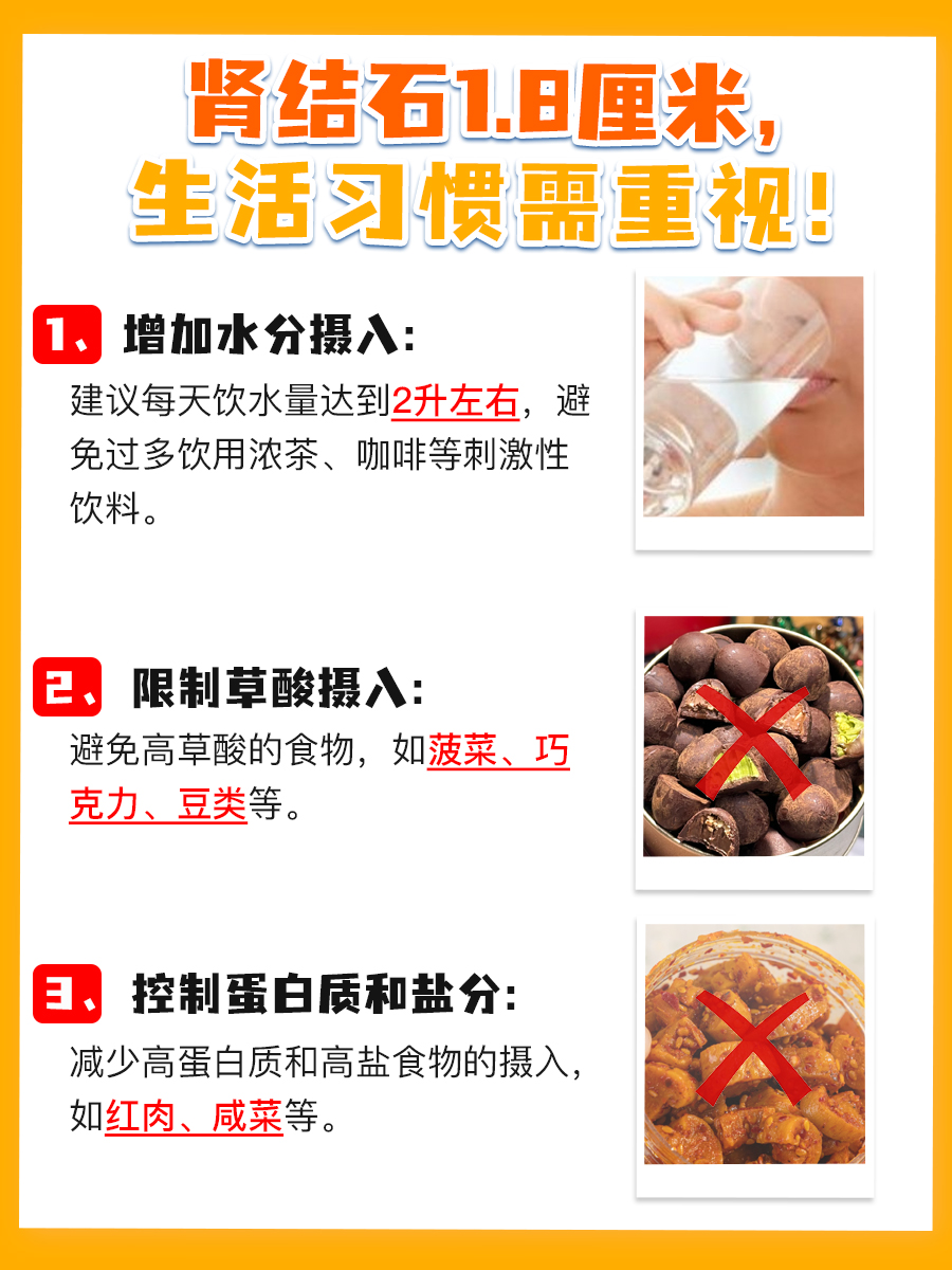 1.8厘米肾结石，是大石头还是小意思？