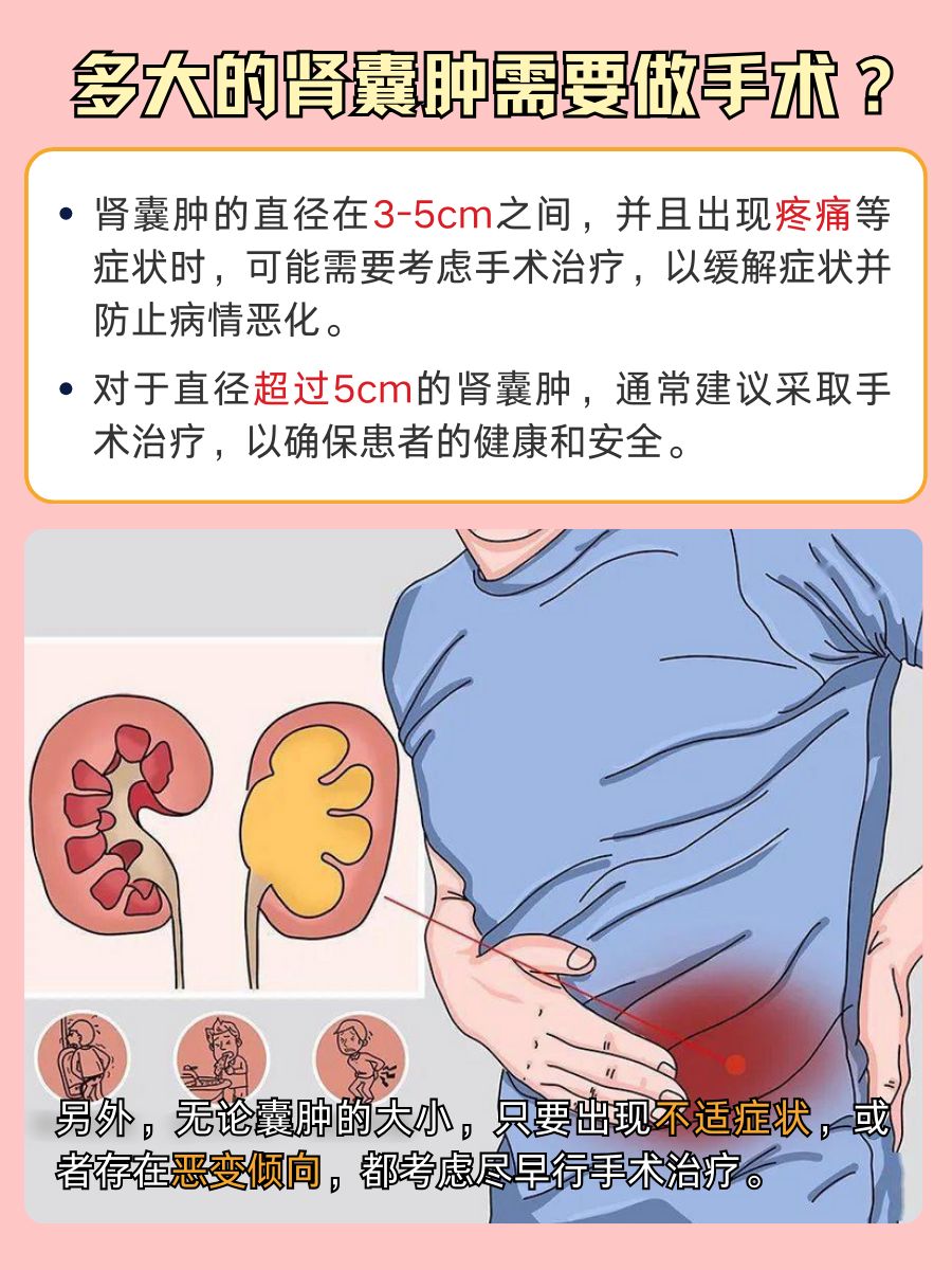 肾囊肿多大需要做手术？医生告诉你答案