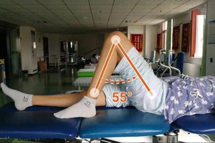 髌骨骨折术后屈曲活动图