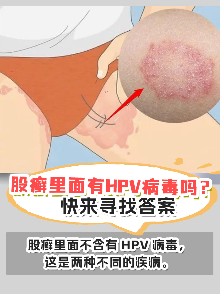 股癣里面有HPV病毒吗?快来寻找答案