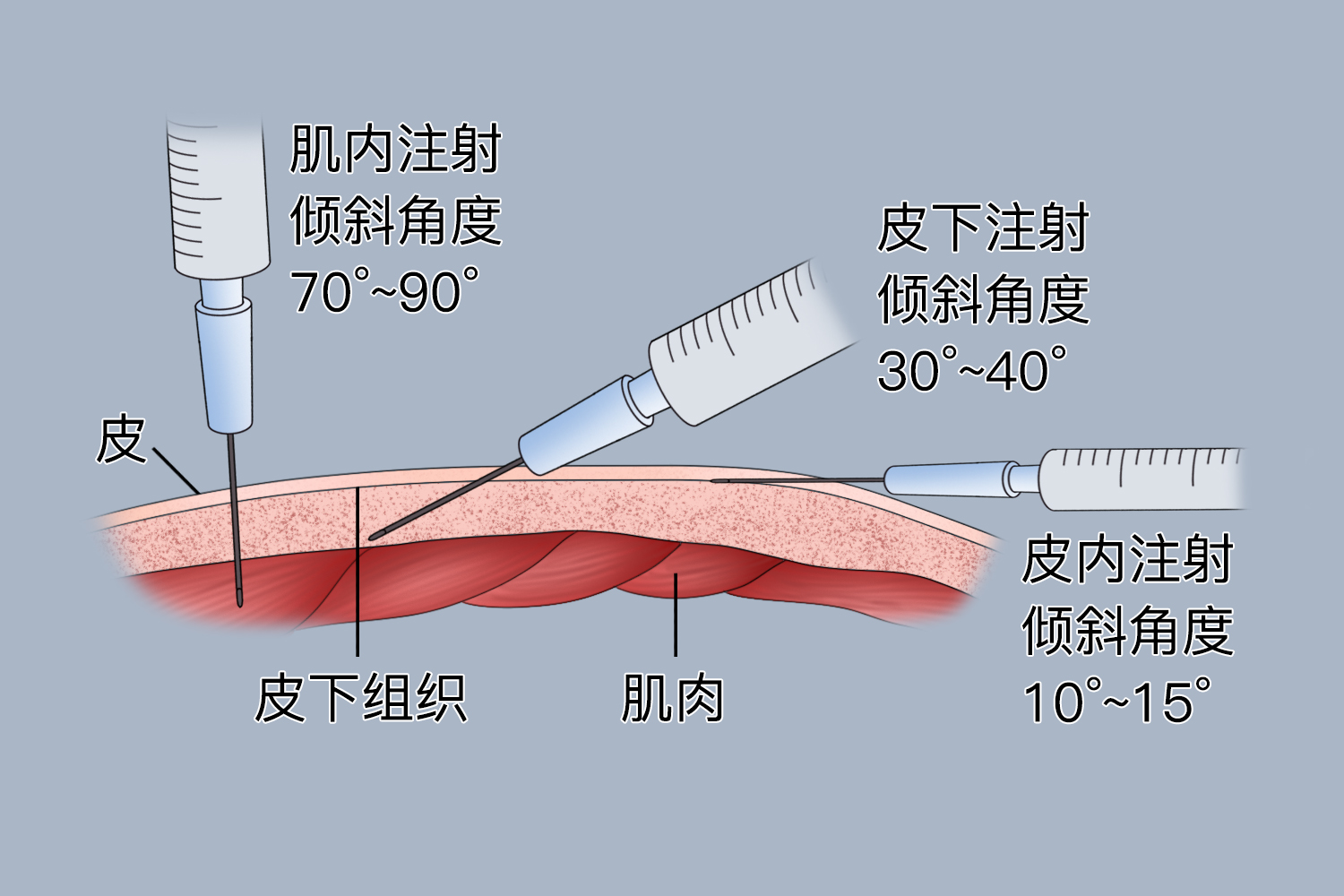 疫苗注射角度图 疫苗注射角度图