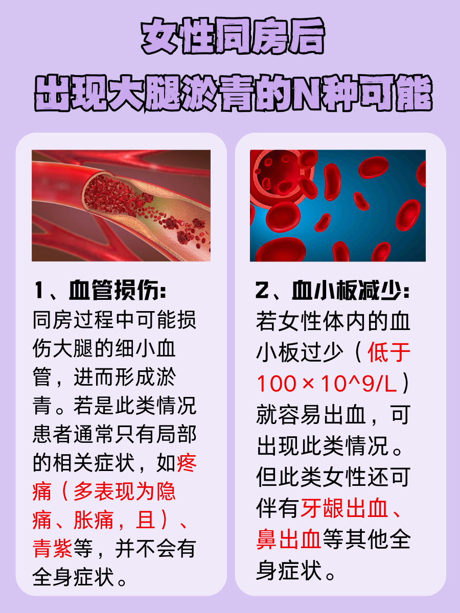 必看！女性同房后出现大腿淤青的N种可能