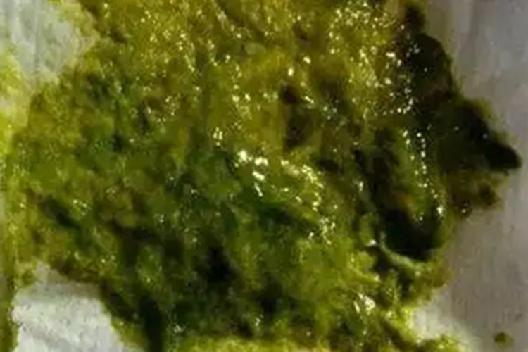 维生素B1缺乏症绿便图